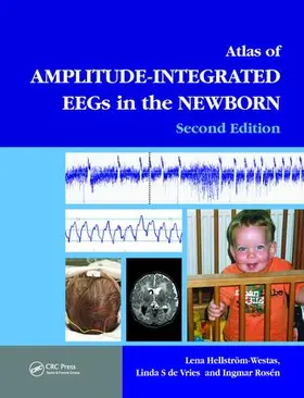 Rosen / Hellström-Westas / Hellstrom-Westas |  An Atlas of Amplitude-Integrated EEGs in the Newborn | Buch |  Sack Fachmedien