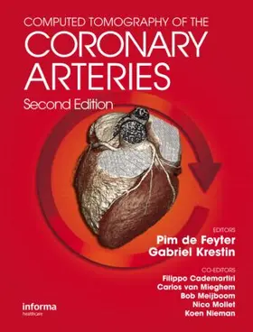 Feyter / de Feyter / Krestin |  Computed Tomography of the Coronary Arteries | Buch |  Sack Fachmedien