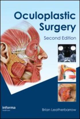 Leatherbarrow |  Oculoplastic Surgery | Buch |  Sack Fachmedien