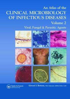 Bottone |  Atlas of the Clinical Microbiology of Infectious Diseases | Buch |  Sack Fachmedien