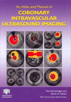 Schoenhagen / Nissen |  An Atlas and Manual of Coronary Intravascular Ultrasound Imaging | Buch |  Sack Fachmedien