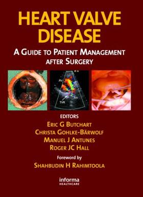Butchart / Gohllke-Barwolf / Antunes |  Heart Valve Disease | Buch |  Sack Fachmedien