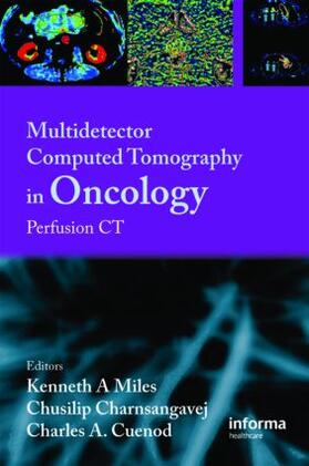 Miles / Charnsangavej / Cuenod |  Multi-Detector Computed Tomography in Oncology | Buch |  Sack Fachmedien