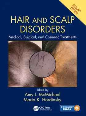 McMichael / Hordinsky |  Hair and Scalp Disorders | Buch |  Sack Fachmedien