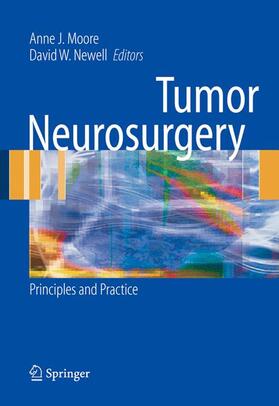 Moore / Newell |  Tumor Neurosurgery | Buch |  Sack Fachmedien