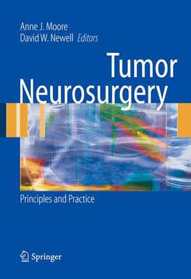 Moore / Newell | Tumor Neurosurgery | Buch | 978-1-84628-291-1 | sack.de