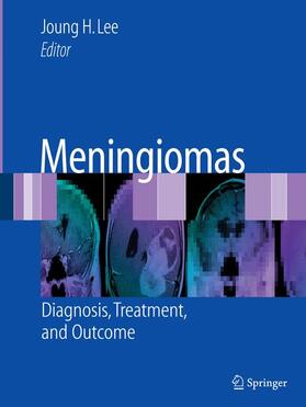 Lee |  Meningiomas | Buch |  Sack Fachmedien