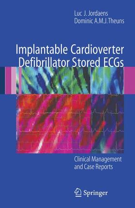 Theuns / Jordaens |  Implantable Cardioverter Defibrillator Stored ECGs | Buch |  Sack Fachmedien