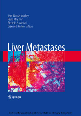 Vauthey / Hoff / Audisio |  Liver Metastases | eBook | Sack Fachmedien