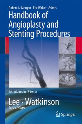 Walser / Morgan |  Handbook of Angioplasty and Stenting Procedures | Buch |  Sack Fachmedien