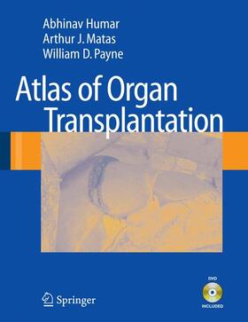Humar / Payne / Matas |  Atlas of Organ Transplantation | Buch |  Sack Fachmedien