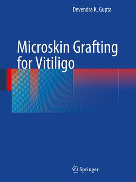 Gupta |  Microskin Grafting for Vitiligo | Buch |  Sack Fachmedien