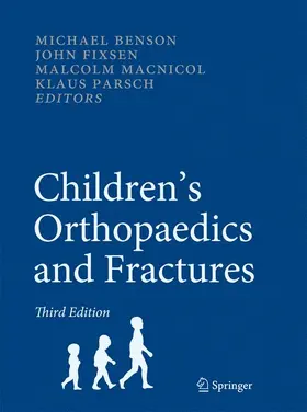 Benson / Fixsen / Macnicol |  Children's Orthopaedics and Fractures | Buch |  Sack Fachmedien