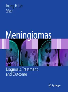 Lee |  Meningiomas | Buch |  Sack Fachmedien