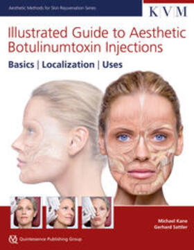 Kane / Sattler |  Illustrated Guide to Aesthetic Botulinumtoxin Injections | Buch |  Sack Fachmedien