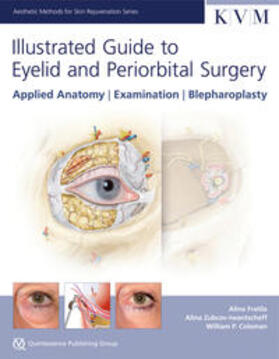 Fratila / Zubcov-Iwantscheff / Coleman |  Illustrated Guide to Eyelid and Periorbital Surgery | Buch |  Sack Fachmedien