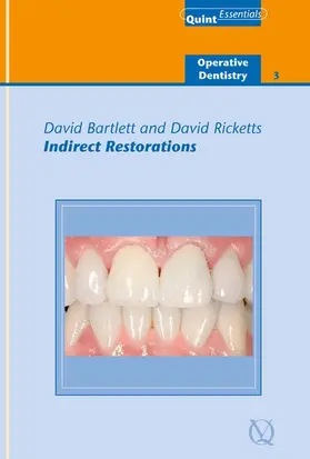 Bartlett / Ricketts |  Indirect Restorations | eBook | Sack Fachmedien