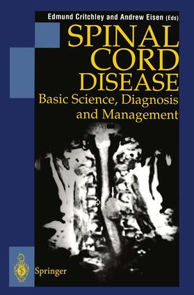 Eisen / Critchley |  Spinal Cord Disease | Buch |  Sack Fachmedien