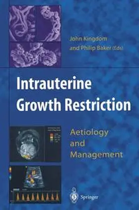 Kingdom / Baker |  Intrauterine Growth Restriction | Buch |  Sack Fachmedien