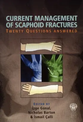 Gunal / Barton / Çalli |  Current Management of Scaphoid Fractures | Buch |  Sack Fachmedien