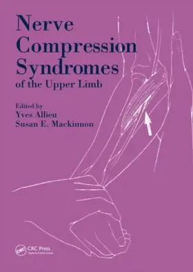 Allieu / Mackinnon |  Nerve Compression Syndromes of the Upper Limb | Buch |  Sack Fachmedien