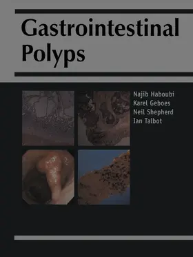 Haboubi / Geobes / Shepherd |  Gastrointestinal Polyps | Buch |  Sack Fachmedien