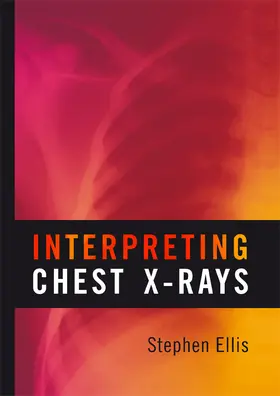 Ellis |  Interpreting Chest X-Rays | Buch |  Sack Fachmedien