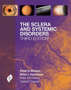 Watson |  Sclera and Systemic Disorders | Buch |  Sack Fachmedien