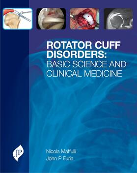 Maffulli |  Rotator Cuff Disorders | Buch |  Sack Fachmedien