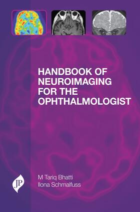 Bhatti / Schmalfuss |  Handbook of Neuroimaging for the Ophthalmologist | Buch |  Sack Fachmedien