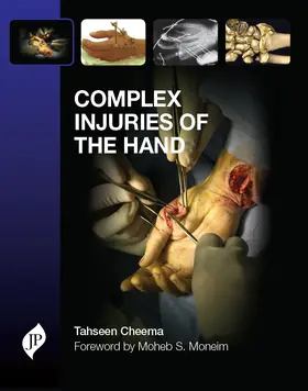 Cheema |  Complex Injuries of the Hand | Buch |  Sack Fachmedien