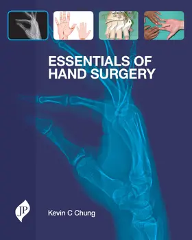 Chung |  Essentials of Hand Surgery | Buch |  Sack Fachmedien