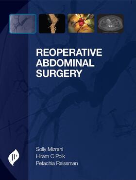 Mizrahi / Reissman / Polk |  Reoperative Abdominal Surgery | Buch |  Sack Fachmedien