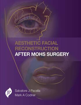 Pacella / Codner |  Aesthetic Facial Reconstruction After Mohs Surgery | Buch |  Sack Fachmedien