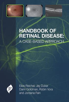 Reichel / Duker / Goldman |  Handbook of Retinal Disease: a Case-based Approach | Buch |  Sack Fachmedien