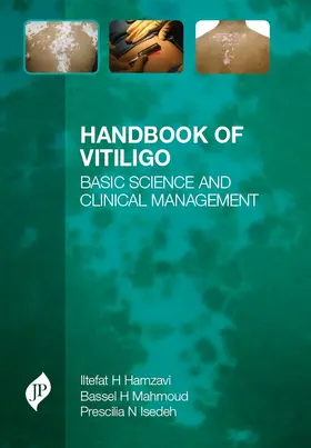 Hamzavi / Mahmoud / Isedeh |  Handbook of Vitiligo | Buch |  Sack Fachmedien