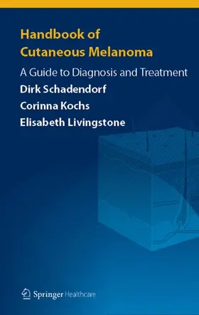 Schadendorf / Livingstone / Kochs |  Handbook of Cutaneous Melanoma | Buch |  Sack Fachmedien