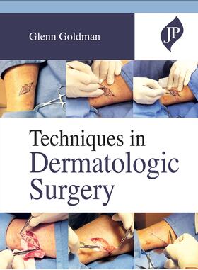 Goldman |  Techniques in Dermatologic Surgery | Buch |  Sack Fachmedien