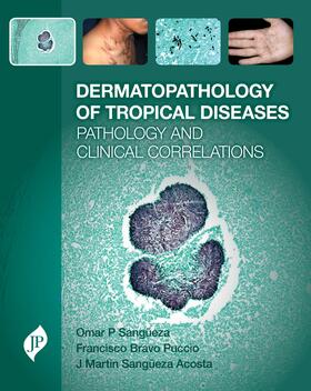Sangueza / Bravo |  Dermatopathology of Tropical Diseases | Buch |  Sack Fachmedien