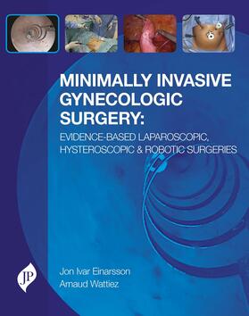 Wattiez / Einarsson |  Minimally Invasive Gynecologic Surgery: Evidence-Based Laparoscopic, Hysteroscopic & Robotic Surgeries | Buch |  Sack Fachmedien