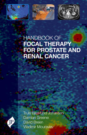 Johansen / Greene / Breen |  Handbook of Focal Therapy for Prostate and Renal Cancer | Buch |  Sack Fachmedien