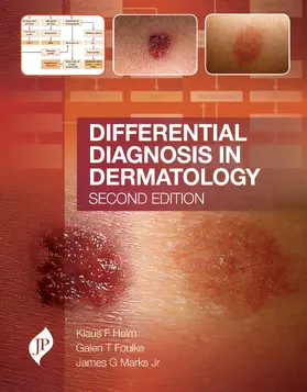 Helm / Marks / Foulke |  Differential Diagnosis in Dermatology | Buch |  Sack Fachmedien