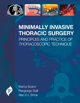 Scarci / Solli / Sihoe |  Minimally Invasive Thoracic Surgery | Buch |  Sack Fachmedien