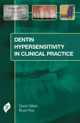 Gillam / Koyi |  Dentin Hypersensitivity in Clinical Practice | Buch |  Sack Fachmedien