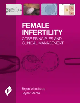 Woodward / Mehta |  Female Infertility | Buch |  Sack Fachmedien