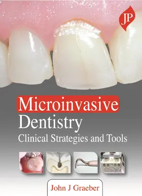 Graeber |  Microinvasive Dentistry | Buch |  Sack Fachmedien