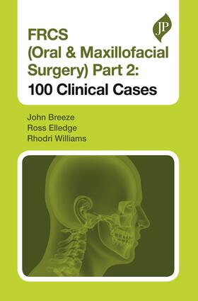 Breeze / Williams / Elledge |  FRCS (Oral & Maxillofacial Surgery) Part 2: 100 Clinical Cases | Buch |  Sack Fachmedien