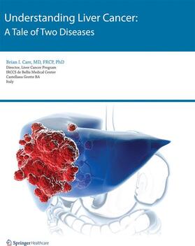 Carr |  Understanding Liver Cancer | Buch |  Sack Fachmedien