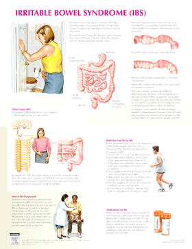  Irritable Bowel Syndrome Chart | Sonstiges |  Sack Fachmedien