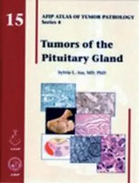 Asa |  Tumors of the Pituitary Gland | Buch |  Sack Fachmedien